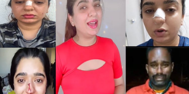 Zomato galate